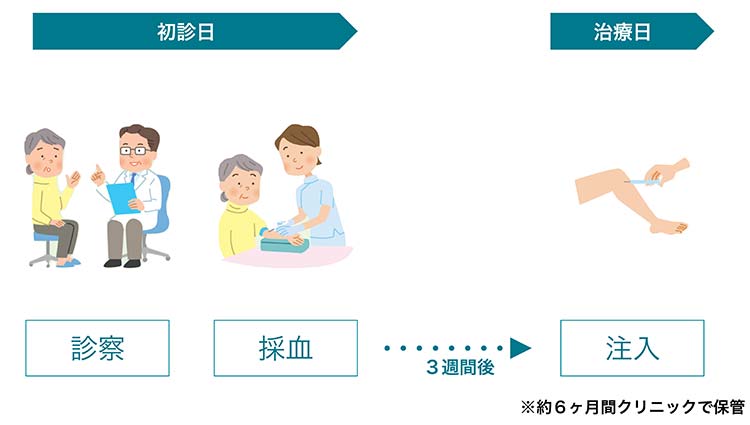 PFC-FD治療の流れ画像